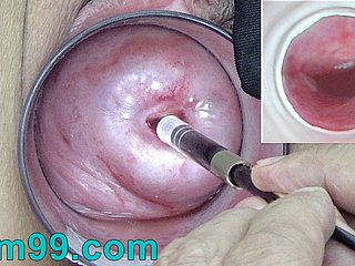 Japanese Endoscope Camera inside Cervix Cam buy Vagina
