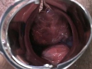 Signora incinta giapponese viene esaminato e succhia lollicock del bones